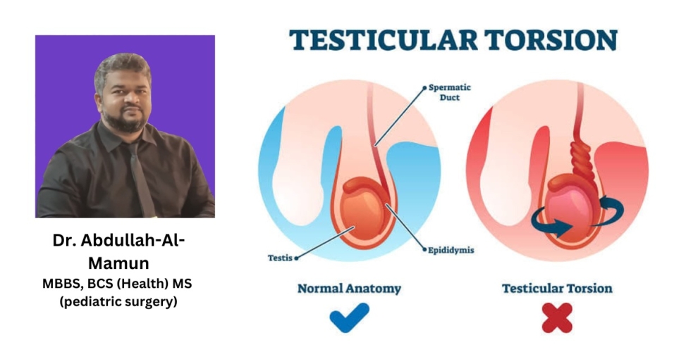 একটি অবহেলিত অণ্ডকোষের (টেস্টিস) আত্নকাহিনীঃ  ডাঃ আব্দুল্লাহ-আল-মামুন এমবিবিএস, বিসিএস (স্বাস্থ্য) এমএস (পেডিয়াট্রিক সার্জারি)